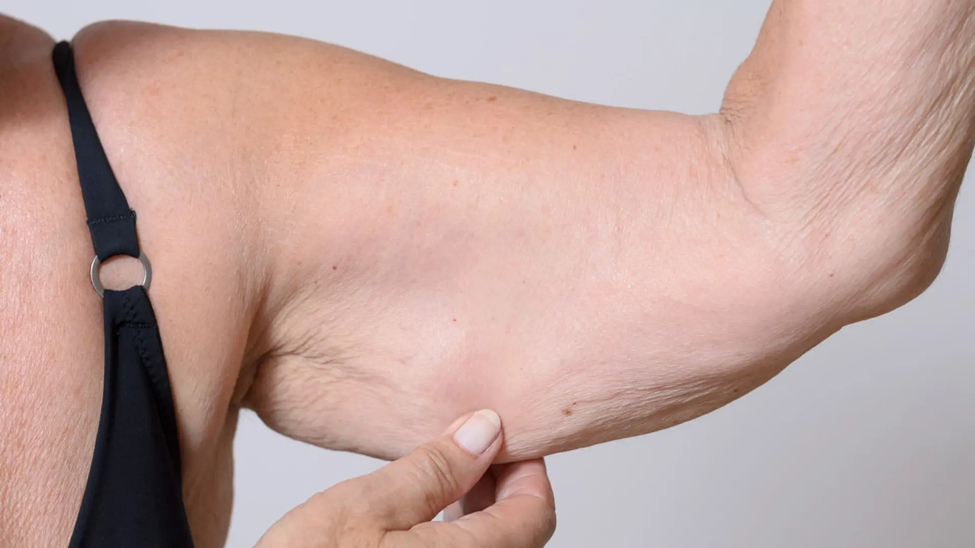 Estudo da USP indica que dieta restritiva sozinha não é suficiente para tratar obesidade com perda muscular em idosos
