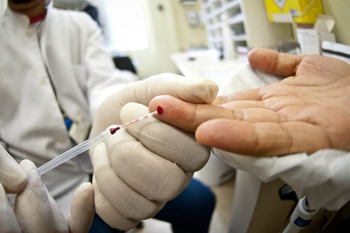 Aumento de casos de HIV em idosos alerta para cuidados e prevenção