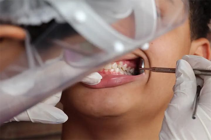 Mato Grosso do Sul pode implantar programa de saúde bucal nas escolas públicas