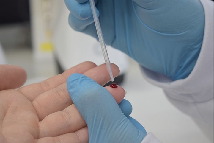 Casos de hepatites crescem em Campo Grande e acendem alerta da Saúde